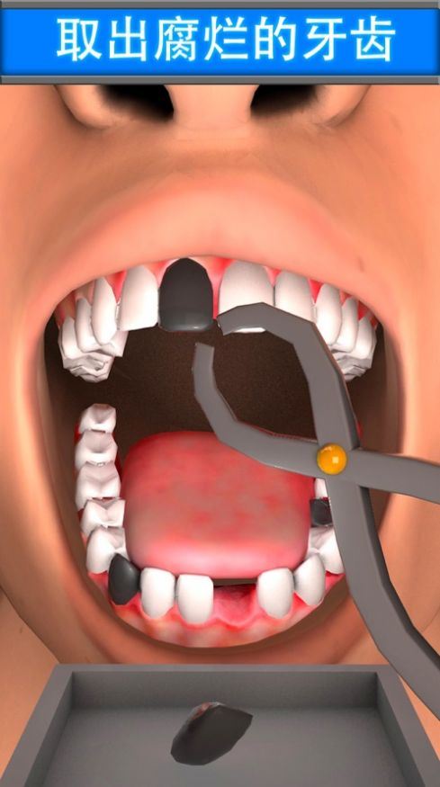 虚拟牙医牙齿童话游戏